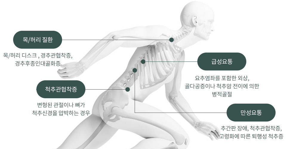 목/허리 질환 : 목/허리 디스크, 경추관협착증, 경추후종인대골화증 / 척추관협착증 : 변형된 관절이나 뼈가 척추신경을 압박하는 경우 / 급성요통 : 요추염좌를 포함한 외상, 골다공증이나 척추암 전이에 의한 병적골절 / 만성요통 : 추간판 장애, 척추관협착증, 고령화에 따른 퇴행성 척추증