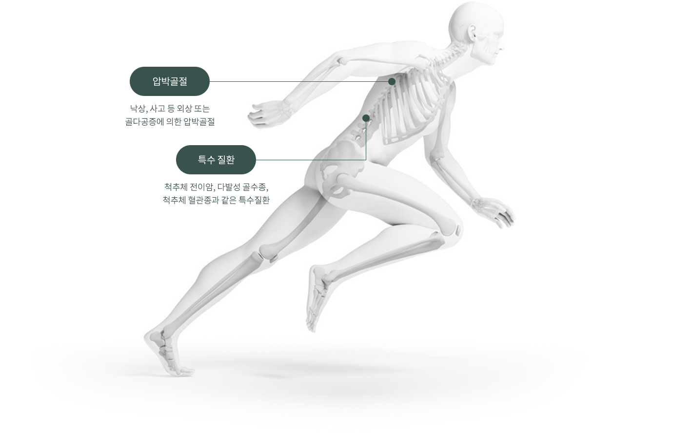 압박골절 : 낙상, 사고 등 외상 또는 골다공증에 의한 압박골절 / 특수 질환 :  척추체 전이암, 다발성 골수종, 척추체혈관정과 같은 특수질환