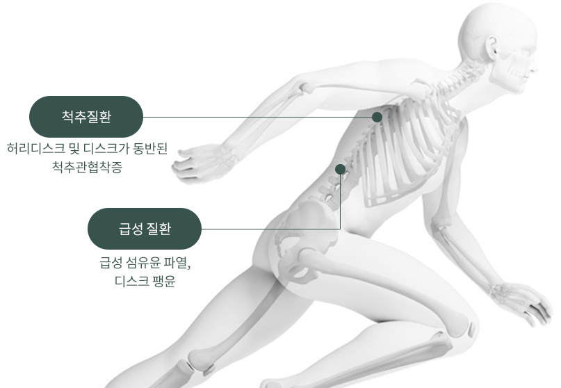 척추질환 : 허리디스크 및 디스크가 동반된 척추관협착증 / 급성 질환 :  급성 섬유윤 파열, 디스크 팽윤