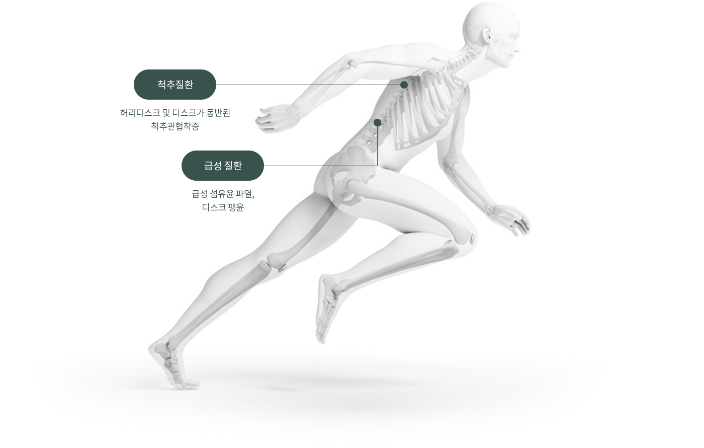 척추질환 : 허리디스크 및 디스크가 동반된 척추관협착증 / 급성 질환 :  급성 섬유윤 파열, 디스크 팽윤