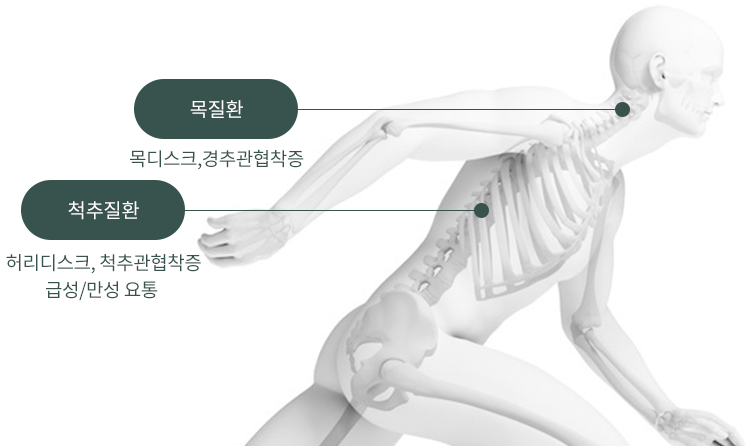 목질환 : 목디스크,경추관협착증 / 척추질환 : 허리디스크, 척추관협착증, 급성/만성 요통