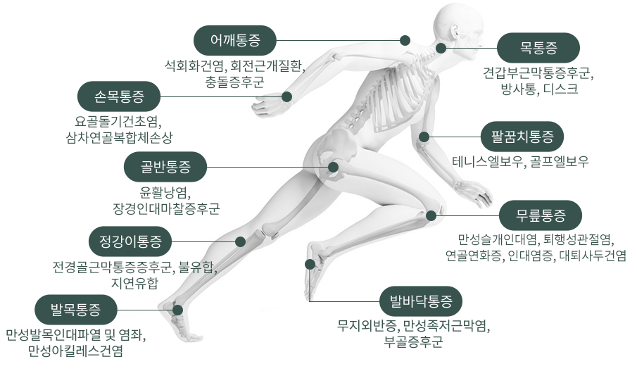 디스크질환 : 디스크탈출증, 디스크내장증, 퇴행성 디스크, 허리디스크 / 척추관협착증 : 변형된 관절이나 뼈가 척추신경을 압박하는 경우 / 급성요통 : 요추염좌를 포함한 외상 골다공증이나 척추암 전이에 의한 병적골절 / 만성요통 : 추간판 장애, 척추관협착증, 고령화에 따른 퇴행성 척추증